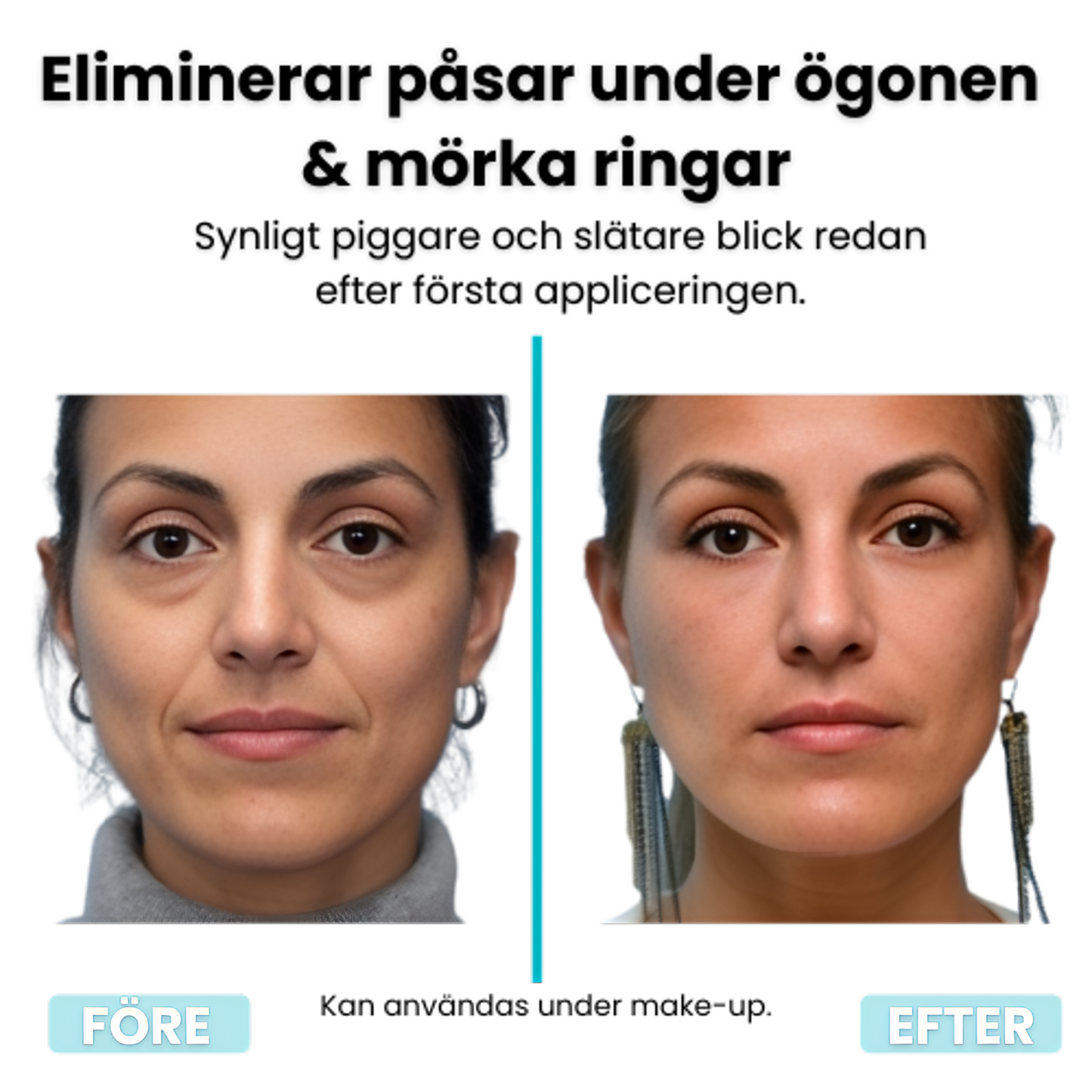 InstantLift™ – Eliminerar ögonpåsar & rynkor!