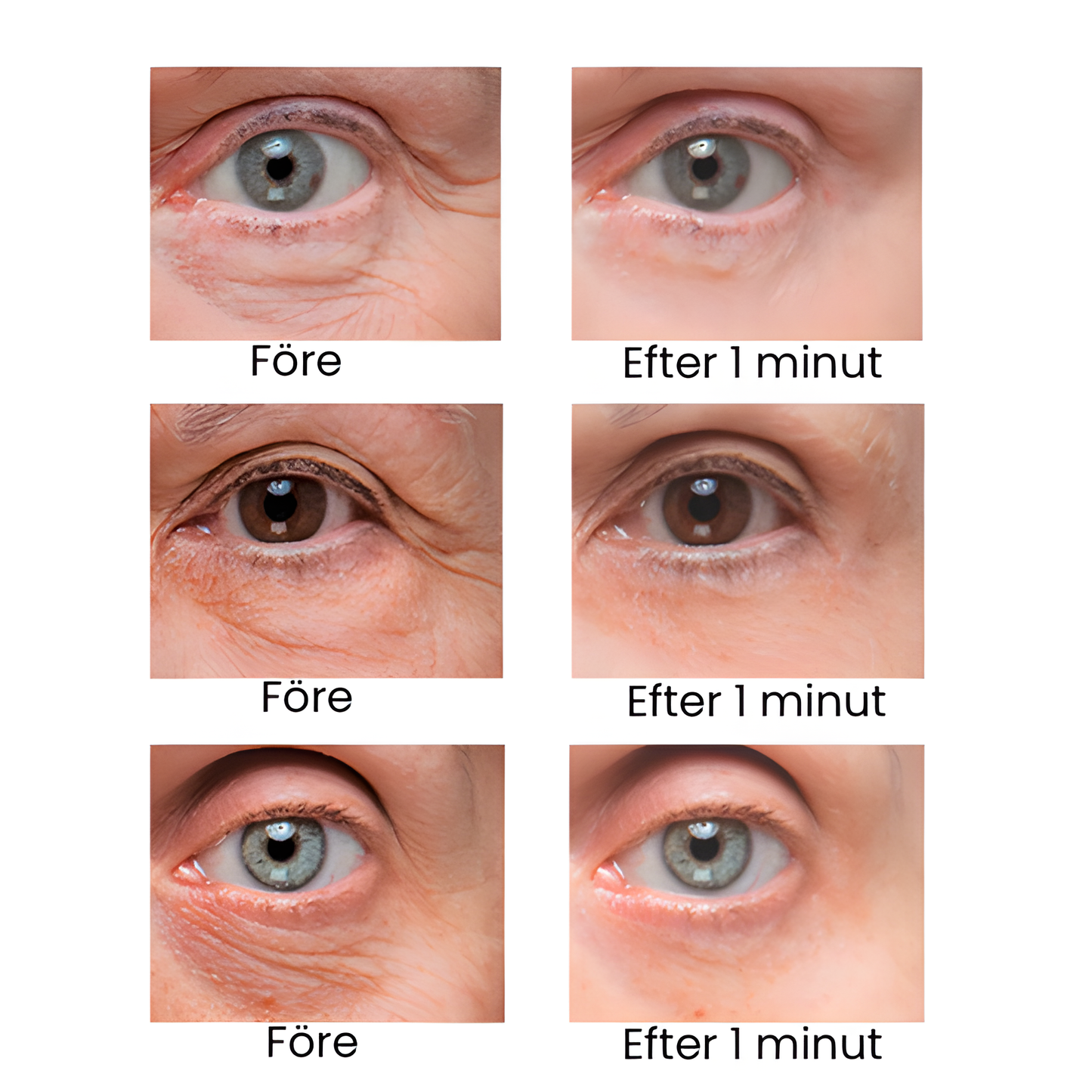 InstantLift™ – Eliminerar ögonpåsar & rynkor!