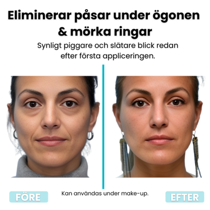 InstantLift™ – Eliminerar ögonpåsar & rynkor!