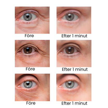 InstantLift™ – Eliminerar ögonpåsar & rynkor!